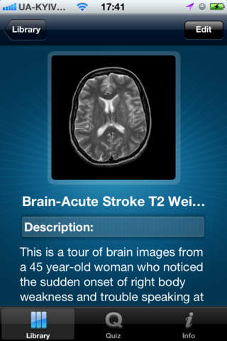 MRI screenshot 3