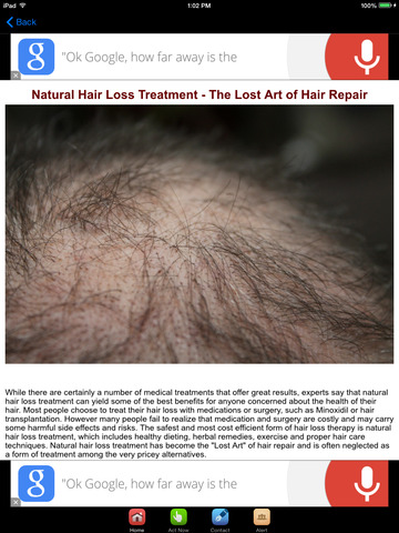 免費下載健康APP|Hair Loss Treatment , Prevention and Cure app開箱文|APP開箱王