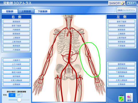 冠動脈3Dアトラス screenshot 3