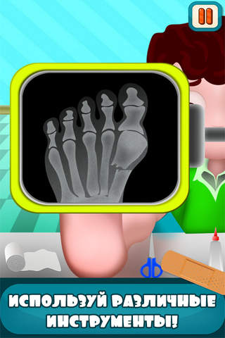 Foot Surgery CROWN screenshot 2