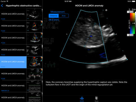 【免費醫療App】CARDIO3® Comprehensive Atlas of Echocardiography [HD]-APP點子