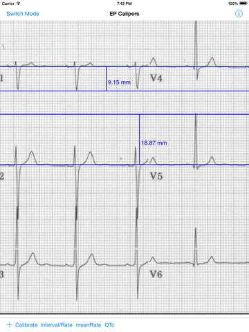 【免費醫療App】EP Calipers-APP點子