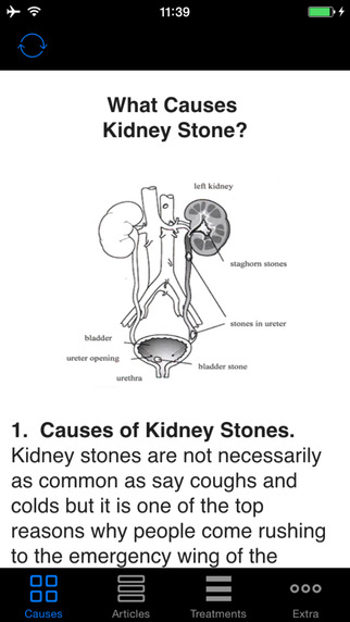 Kidney Stones - Symptoms Signs Pains Treatments