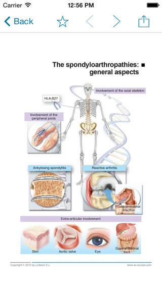 【免費醫療App】Miniatlas Diseases of the vertebral column-APP點子