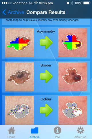 Doctor Mole Australia - Skin Cancer App screenshot 3