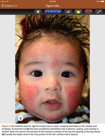 【免費醫療App】Pediatric Dermatology 4e-APP點子