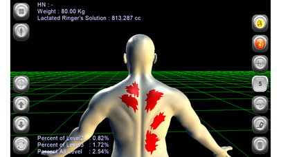 3D Burn Resuscitation screenshot 2