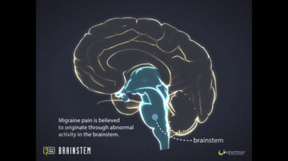 Migraine: Did You Know? screenshot 3
