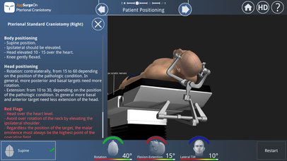 Pterional Craniotomy screenshot 4