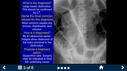 Basic RadiologyLite–SecondLook screenshot 3