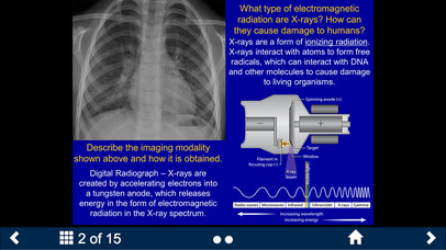Basic Radiology - SecondLook screenshot 3