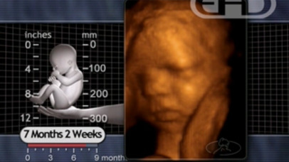 Options Pregnancy Center screenshot 4
