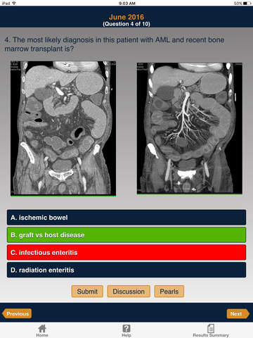 CTisus iQuiz: The HD Edition screenshot 2