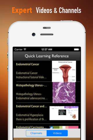 Uterine Cancer:Diet,News and Cancer screenshot 3