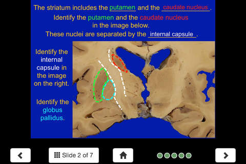 Neuroanatomy Lite - SecondLook screenshot 3