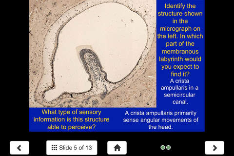 Histology - Nervous System screenshot 4