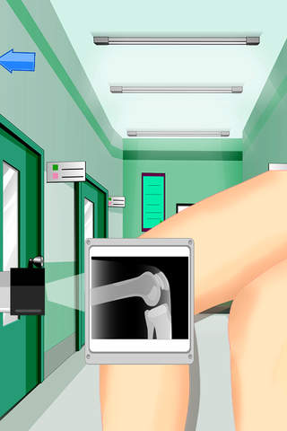 Knee Surgery - Amateur Surgeon and doctor game screenshot 3