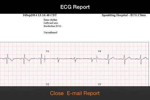 Spaulding ECG screenshot 4