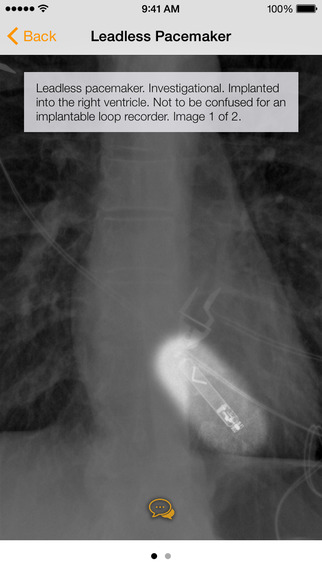 Atlas of Medical Devices on Chest X-Ray