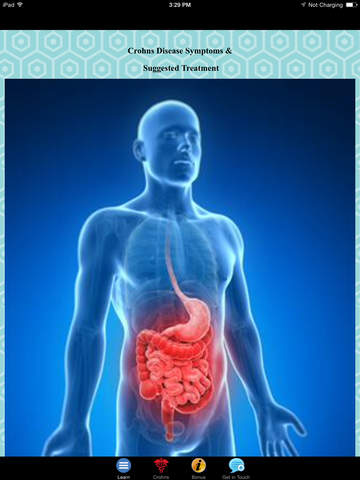 【免費醫療App】Crohns Disease Symptoms & Suggested Treatment-APP點子