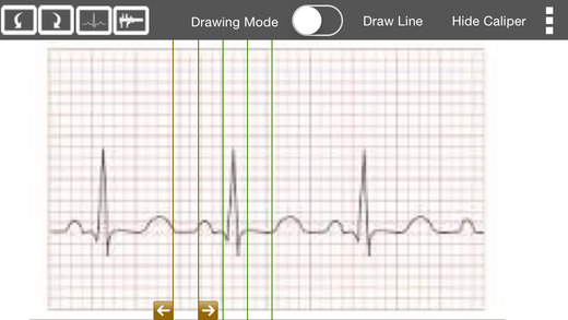 【免費醫療App】ECG Analyser-APP點子