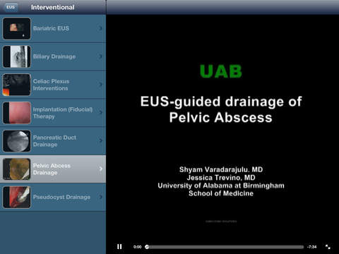 【免費醫療App】EUS - Diagnostic and Interventional Endoscopic Ultrasound-APP點子