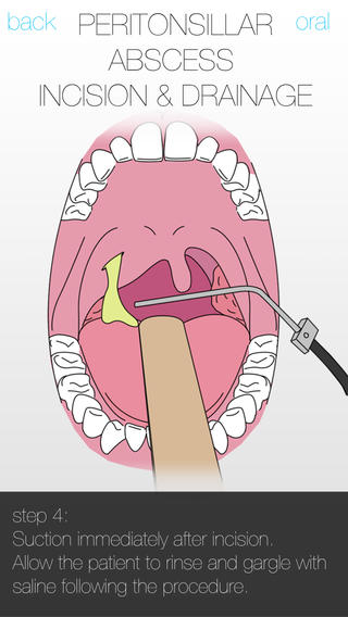 【免費醫療App】Surgical Anatomy & Procedures-APP點子