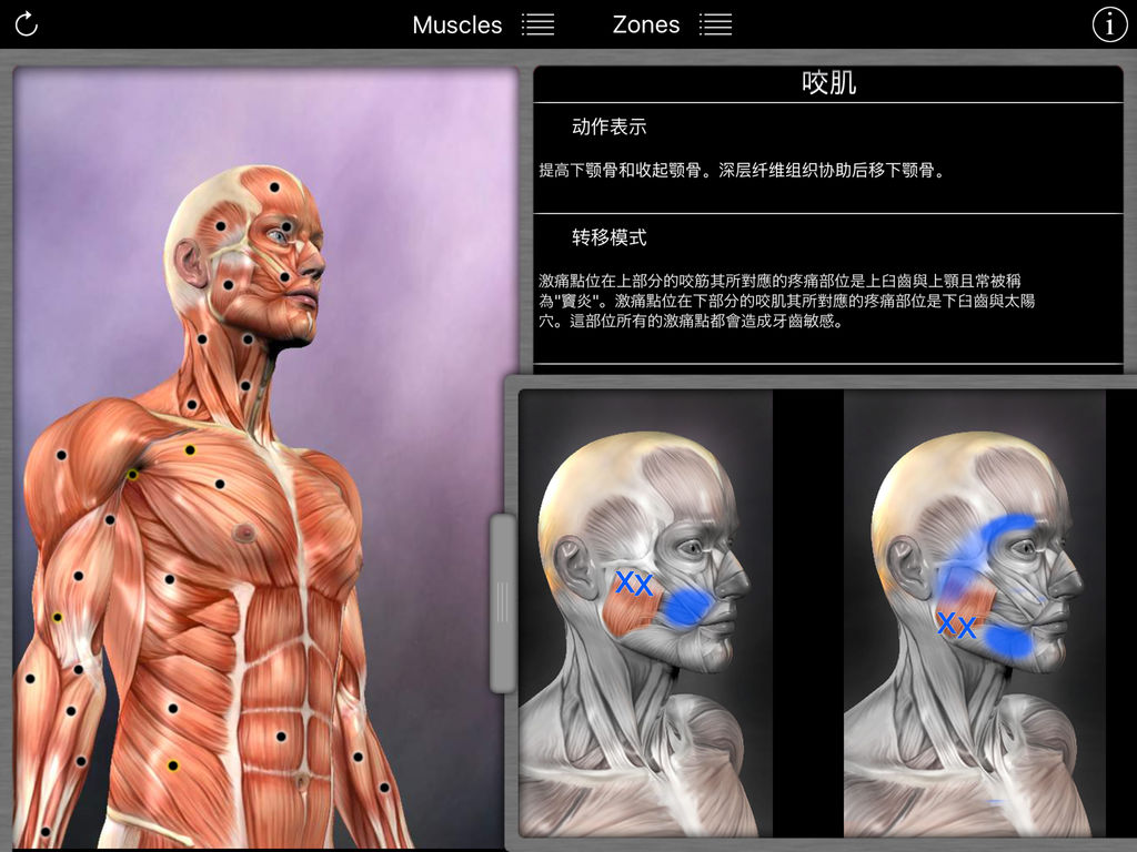 肌肉激痛点