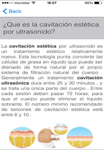 Cavitacion Estetica - náhled
