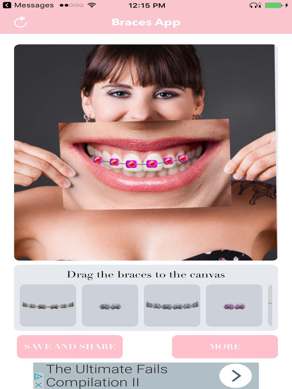 Braces App Apps 148Apps