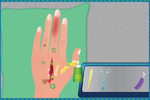 Hand Surgery - Free doctor surgeon and medical car - náhled
