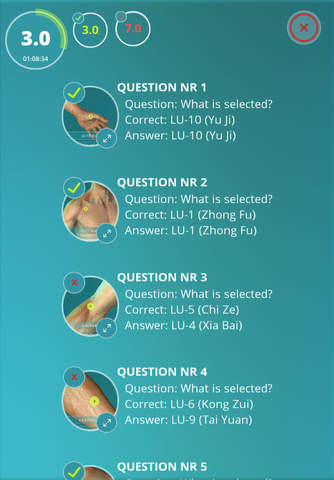 Acupuncture Quiz - Point Locations - náhled